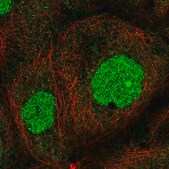 Anti-ZNF791 antibody produced in rabbit Prestige Antibodies® Powered by Atlas Antibodies, affinity isolated antibody, buffered aqueous glycerol solution