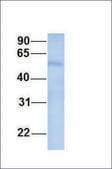 Anti-SEPT9 antibody produced in rabbit affinity isolated antibody