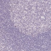 Anti-KIAA1210 antibody produced in rabbit Prestige Antibodies&#174; Powered by Atlas Antibodies, affinity isolated antibody, buffered aqueous glycerol solution