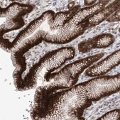 Anti-KIAA1522 antibody produced in rabbit Prestige Antibodies&#174; Powered by Atlas Antibodies, affinity isolated antibody