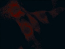 Anti-Superoxide Dismutase (MnSOD) (DD-17)&#8722;Cy3 antibody produced in rabbit 1-2&#160;mg/mL, affinity isolated antibody, buffered aqueous solution
