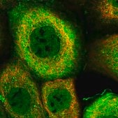 Anti-DNAJB4 antibody produced in rabbit Prestige Antibodies&#174; Powered by Atlas Antibodies, affinity isolated antibody, buffered aqueous glycerol solution, ab2