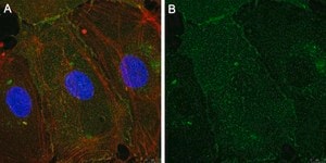 Anti-Integrin αVβ3 Antibody, clone LM609 ZooMAb® Mouse Monoclonal recombinant, expressed in HEK 293 cells