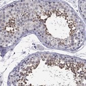 Anti-BCL2L14 antibody produced in rabbit Prestige Antibodies&#174; Powered by Atlas Antibodies, affinity isolated antibody, buffered aqueous glycerol solution