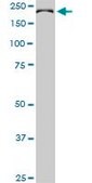 Monoclonal Anti-CDC42BPB antibody produced in mouse clone 2F4, purified immunoglobulin, buffered aqueous solution