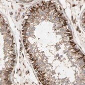 Anti-TRAF2 antibody produced in rabbit Ab2, Prestige Antibodies&#174; Powered by Atlas Antibodies, affinity isolated antibody, buffered aqueous glycerol solution