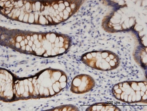 Monoclonal Anti-ARFIP1, (N-terminal) antibody produced in mouse clone 1F10, purified immunoglobulin, buffered aqueous solution