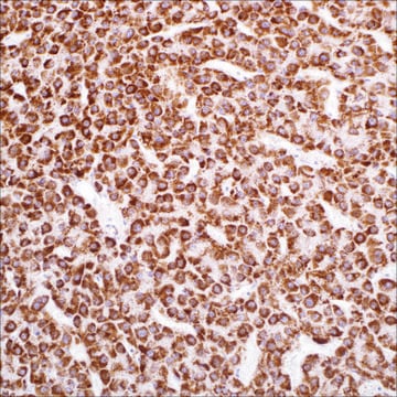 Hepatocyte Specific Antigen (Hep-Par1) (EP265) Rabbit Monoclonal Primary Antibody
