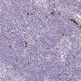 Anti-LYZ antibody produced in rabbit Prestige Antibodies&#174; Powered by Atlas Antibodies, affinity isolated antibody, buffered aqueous glycerol solution