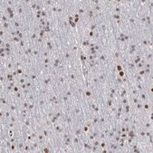 Anti-PPP4R3B antibody produced in rabbit Prestige Antibodies&#174; Powered by Atlas Antibodies, affinity isolated antibody, buffered aqueous glycerol solution