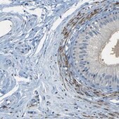 Anti-ZMAT1 antibody produced in rabbit Prestige Antibodies&#174; Powered by Atlas Antibodies, affinity isolated antibody, buffered aqueous glycerol solution