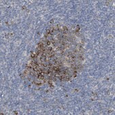 Anti-UBAP2 antibody produced in rabbit Prestige Antibodies® Powered by Atlas Antibodies, affinity isolated antibody, buffered aqueous glycerol solution
