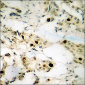 Anti-phospho-NPM (pThr199) antibody produced in rabbit affinity isolated antibody