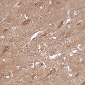 Anti-PCDH1 antibody produced in rabbit Prestige Antibodies&#174; Powered by Atlas Antibodies, affinity isolated antibody, buffered aqueous glycerol solution