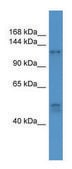 Anti-COL1A1 (C-terminal) antibody produced in rabbit affinity isolated antibody
