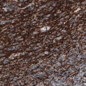 Monoclonal Anti-CNP antibody produced in mouse Prestige Antibodies® Powered by Atlas Antibodies, clone CL2871, purified immunoglobulin, buffered aqueous glycerol solution