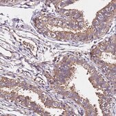 Anti-LRRIQ1 antibody produced in rabbit Prestige Antibodies&#174; Powered by Atlas Antibodies, affinity isolated antibody, buffered aqueous glycerol solution