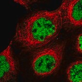 Anti-U2SURP antibody produced in rabbit Prestige Antibodies® Powered by Atlas Antibodies, affinity isolated antibody, buffered aqueous glycerol solution