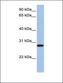 Anti-VDAC3 antibody produced in rabbit affinity isolated antibody