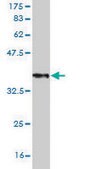 Monoclonal Anti-DDX26 antibody produced in mouse clone 3D9, purified immunoglobulin, buffered aqueous solution