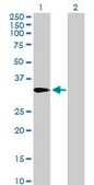 Anti-AMT, (N-terminal) antibody produced in mouse purified immunoglobulin, buffered aqueous solution