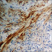 Anti-phospho-Neutrophil Cytosol Factor 1 (pSer328) antibody produced in rabbit affinity isolated antibody