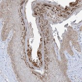 Anti-SLAMF9 antibody produced in rabbit Prestige Antibodies® Powered by Atlas Antibodies, affinity isolated antibody, buffered aqueous glycerol solution