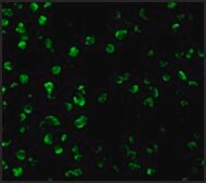 Anti-SARM antibody produced in rabbit IgG fraction of antiserum, buffered aqueous solution