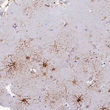 Anti-INTS13 antibody produced in rabbit Prestige Antibodies® Powered by Atlas Antibodies, affinity isolated antibody, buffered aqueous glycerol solution