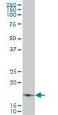 Monoclonal Anti-NDUFB7 antibody produced in mouse clone 4D4, purified immunoglobulin, buffered aqueous solution