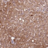 Anti-ETFBKMT antibody produced in rabbit Prestige Antibodies® Powered by Atlas Antibodies, affinity isolated antibody, buffered aqueous glycerol solution