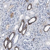 Anti-GRAMD1A antibody produced in rabbit Prestige Antibodies&#174; Powered by Atlas Antibodies, affinity isolated antibody, buffered aqueous glycerol solution