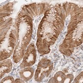 Anti-BCL2L15 antibody produced in rabbit Prestige Antibodies&#174; Powered by Atlas Antibodies, affinity isolated antibody, buffered aqueous glycerol solution, ab2