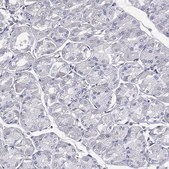 Anti-CCDC70 antibody produced in rabbit Prestige Antibodies&#174; Powered by Atlas Antibodies, affinity isolated antibody, buffered aqueous glycerol solution