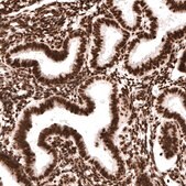 Monoclonal Anti-H2AFX antibody produced in mouse Prestige Antibodies&#174; Powered by Atlas Antibodies, clone CL5157, purified immunoglobulin, buffered aqueous glycerol solution