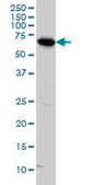 Monoclonal Anti-ARAF antibody produced in mouse clone 3E2, purified immunoglobulin, buffered aqueous solution
