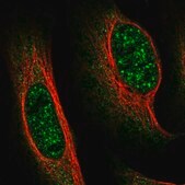 Anti-FAM160B1 antibody produced in rabbit Prestige Antibodies&#174; Powered by Atlas Antibodies, affinity isolated antibody, buffered aqueous glycerol solution