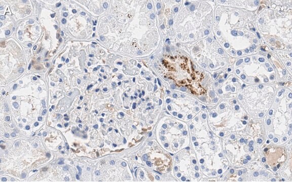 Anti-PEDF (SERPIN F1) Antibody, clone 2C16 ZooMAb&#174; Rabbit Monoclonal recombinant, expressed in HEK 293 cells