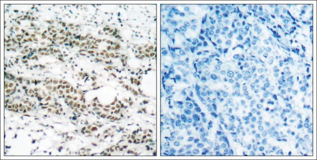 Anti-phospho-FOXO4 (pSer197) antibody produced in rabbit affinity isolated antibody