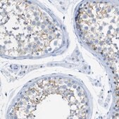 抗-ERVMER34-1 兔抗 Prestige Antibodies&#174; Powered by Atlas Antibodies, affinity isolated antibody, buffered aqueous glycerol solution