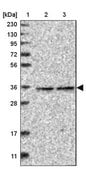 Anti-RABGGTB antibody produced in rabbit Prestige Antibodies&#174; Powered by Atlas Antibodies, affinity isolated antibody, buffered aqueous glycerol solution, Ab1