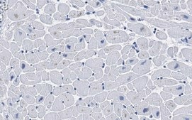 Anti-Ryanodine Receptor 2 Antibody, clone 2K6 ZooMAb® Rabbit Monoclonal recombinant, expressed in HEK 293 cells