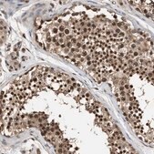 Anti-SCAI antibody produced in rabbit Prestige Antibodies® Powered by Atlas Antibodies, affinity isolated antibody, buffered aqueous glycerol solution