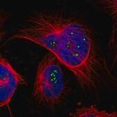 Anti-TMEM143 antibody produced in rabbit Prestige Antibodies&#174; Powered by Atlas Antibodies, affinity isolated antibody, buffered aqueous glycerol solution