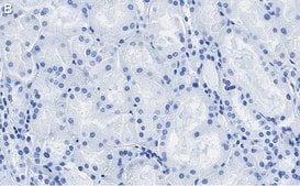 Anti-Occludin Antibody, clone 1C17 ZooMAb&#174; Rabbit Monoclonal recombinant, expressed in HEK 293 cells