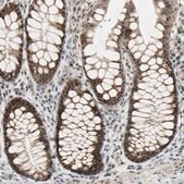 Anti-DHRS7B antibody produced in rabbit Prestige Antibodies&#174; Powered by Atlas Antibodies, affinity isolated antibody, buffered aqueous glycerol solution