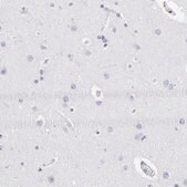 Anti-CD180 antibody produced in rabbit Prestige Antibodies&#174; Powered by Atlas Antibodies, affinity isolated antibody, buffered aqueous glycerol solution