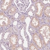 Anti-TMEM27 antibody produced in rabbit Prestige Antibodies&#174; Powered by Atlas Antibodies, affinity isolated antibody, buffered aqueous glycerol solution