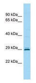 Anti-CEMP1 (C-terminal) antibody produced in rabbit affinity isolated antibody