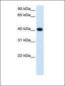 Anti-ADH4 antibody produced in rabbit IgG fraction of antiserum